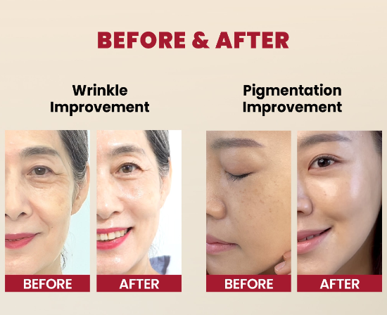 كريم مرطب الريتنال من كي سكريت كريم مرطب بمستخلص الحلزون والأرز - الصورة 2